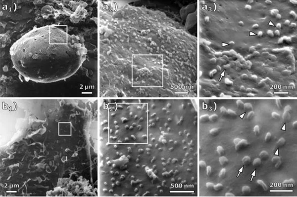 Cientistas conseguem novas imagens de interação entre Sars-CoV-2 e células