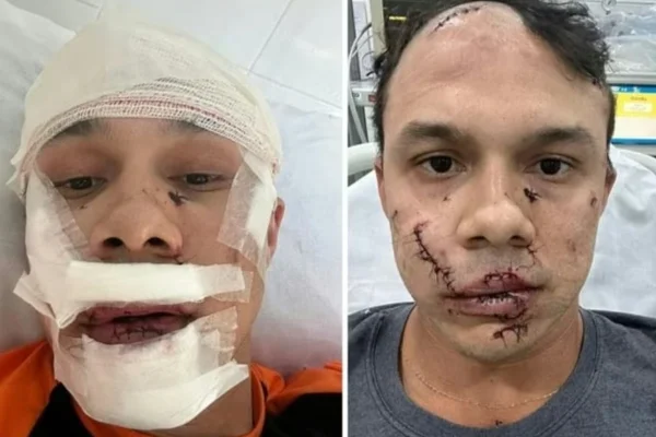 Homem que desfigurou personal em briga é filho de empresário do DF