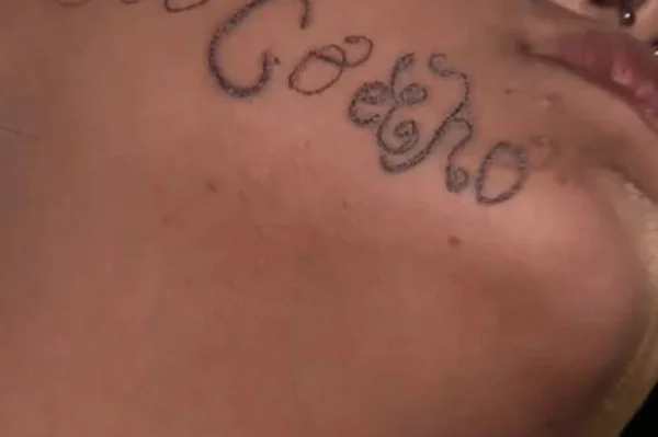 Mãe registra boletim de ocorrência após filha ser encontrada com tatuagem no rosto com o nome do ex-namorado