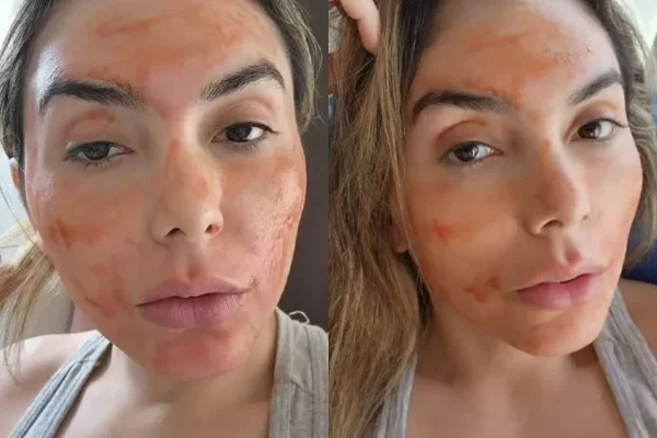 mulher com rosto cheio de sangue menstrual