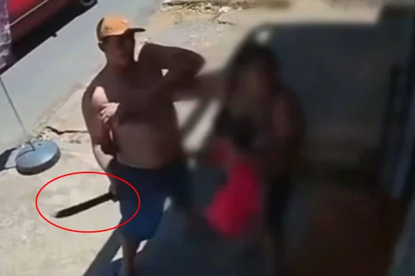 Mulher com bebê no colo é agredida com vários golpes de facão