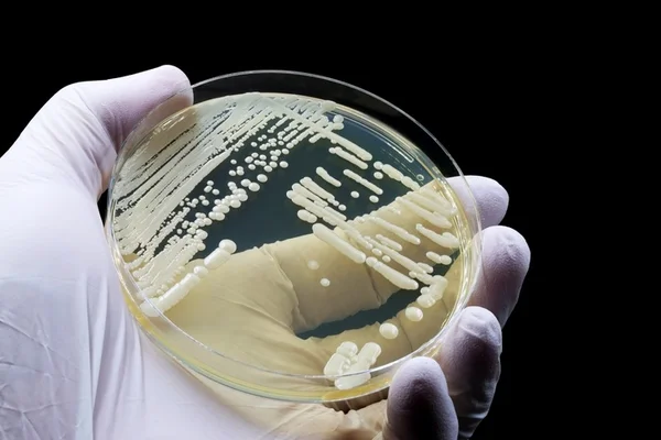 Apesar de tratáveis, infecções por Candida ainda tem alta mortalidade no Brasil