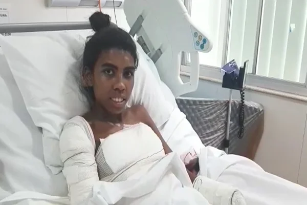 Jovem arrastada por 4 km no Lago Sul recebe alta: “Não vou desistir nunca”