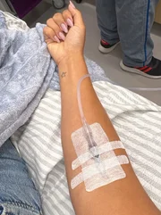 Simone Mendes mostra o braço após se sentir mal