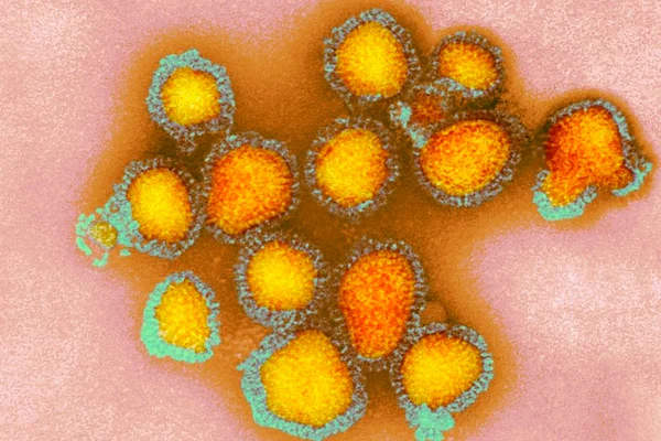 Fotografia colorida. Vírus influenza em imagem de microscópio