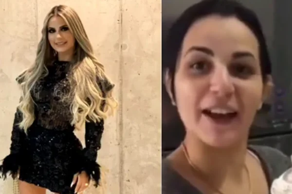 Deolane antes e depois