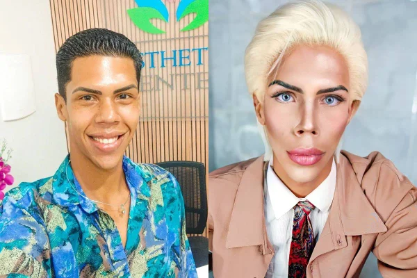 "Ken Humano" desiste de customização e tenta a vida como frentista em SP - Metrópoles