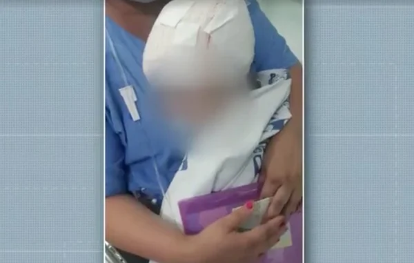 Menina de dois anos foi atacada por cão no conjunto Residencial Victor D'Andrea, Limeira