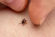 Ticks can also lodge in the skin of humans.
