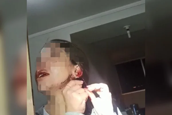 Mulher esfaqueada pelo namorado pediu ajuda a autoridades durante anos