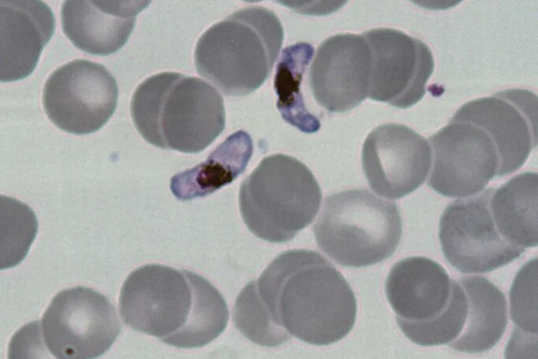 Foto miscroscópica e colorida de vírus da malária em um organismo vivo - Metrópoles.