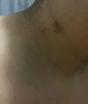 Pescoço da mulher ficou roxo com as agressões