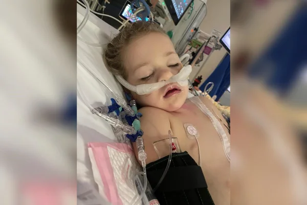 Imagem colorida de criança que engoliu ímã em coma - Metrópoles