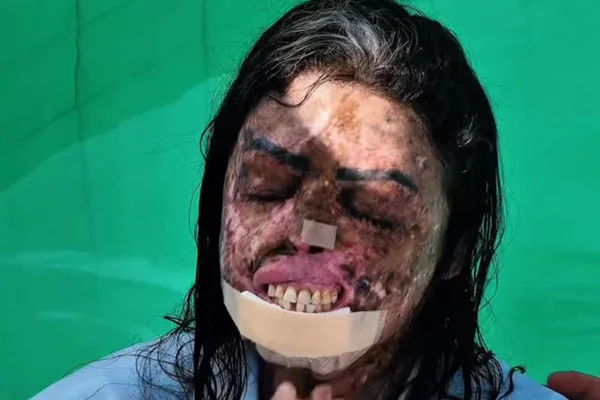 Morre Karine Felipe, influencer que lutava contra doença rara - destaque galeria