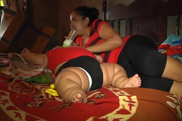 Síndrome faz bebê de 10 meses pesar o mesmo que uma criança de 9 anos