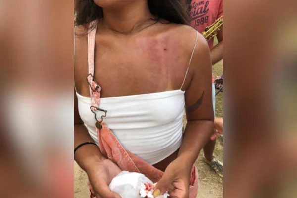 Rio: foliã leva tiro de chumbinho durante ensaio de bloco de rua