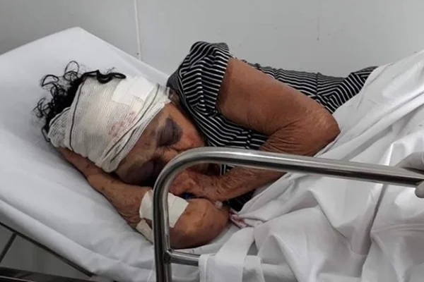 Idosa de 81 anos morre após ser espancada em assalto no Maranhão