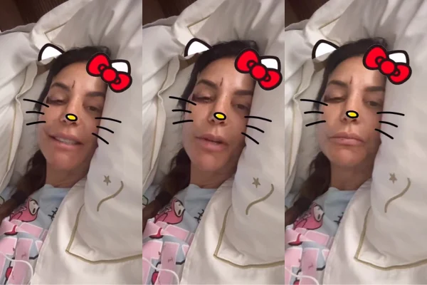 Ivete Sangalo surge machucada e se pronuncia sobre internação