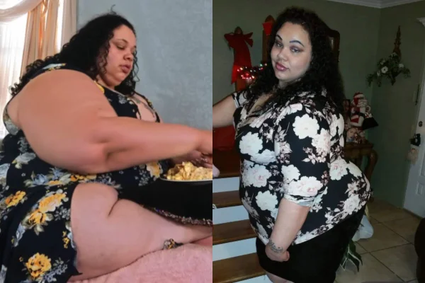Foto colorida de uma mulher obesa - Metrópoles