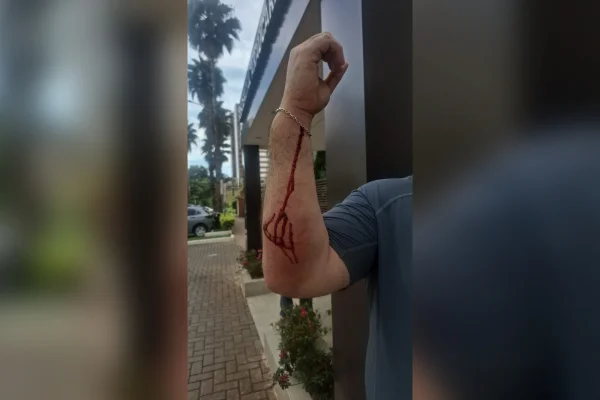 PM foi agredido pelo morador de rua
