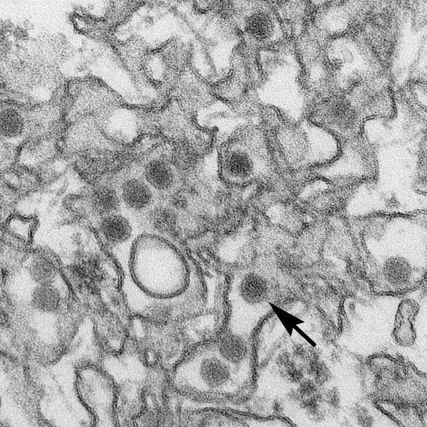 Cientistas descobrem possível entrada do zika em célula-tronco neural