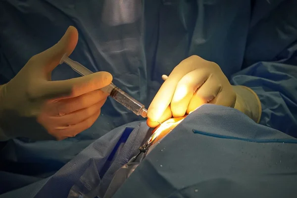 Imagem ilustrativa de uma cirurgia de catarata - Metrópoles