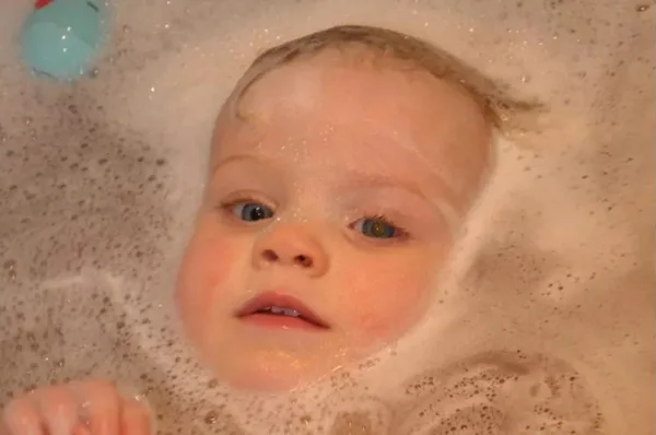 Após foto tirada com flash, mãe descobre câncer da filha de 1 ano