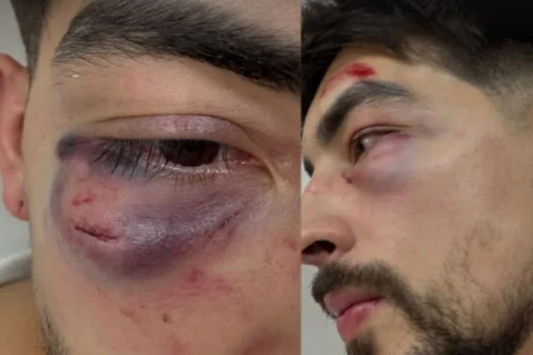 Imagens coloridas mostram postagem com rosto de homem ferido após agressão em karaokê, conforme denúncia da vítima