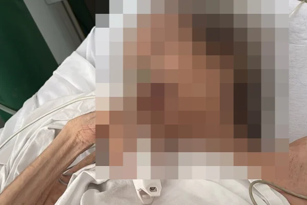 Imagem colorida e borrada de idosa deitada em cama hospitalar