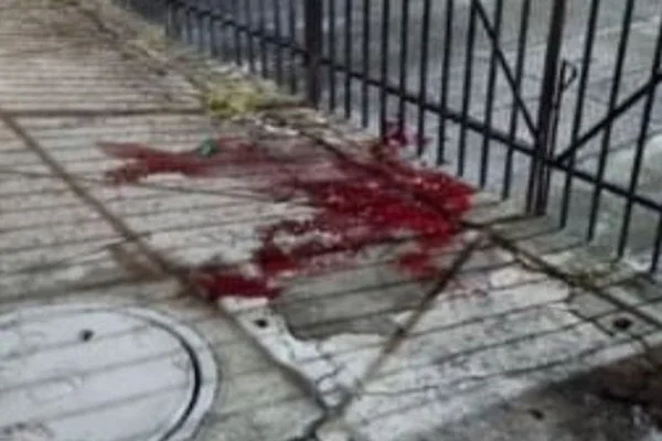 Imagem colorida de poça de sangue - Metrópoles