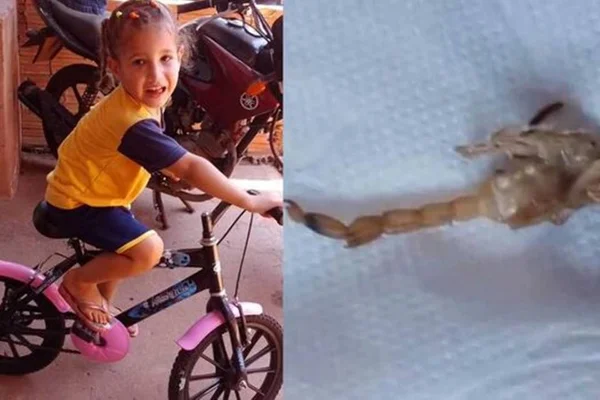 Foto colorida de menina picada por escorpião em Mato Grosso do Sul - Metrópoles