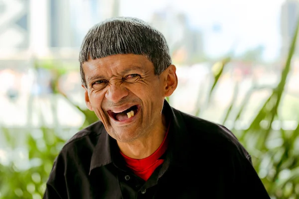 Sonho de Natal. Ivanildo pediu dentes ao Papai Noel e você pode ajudar