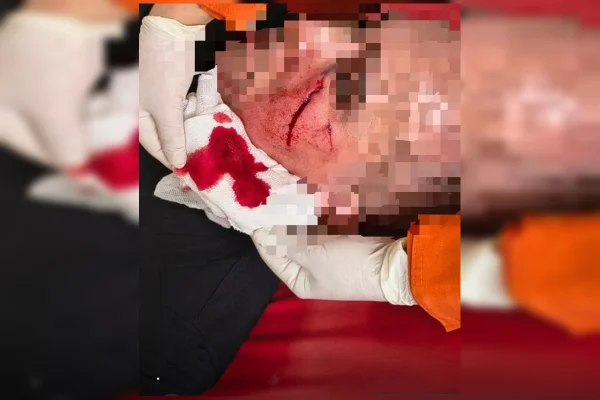 PM é atacado com telha durante ocorrência de violência doméstica