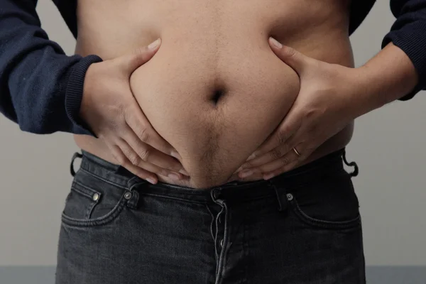 foto colorida de homem segurando pele/gordura da barriga - Metrópoles.