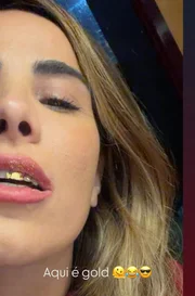 Wanessa Camargo popsou com ouro nos dentes e nos lábios Wanessa Camargo popsou com ouro nos dentes e nos lábios