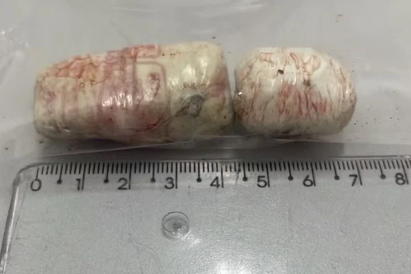 Imagem colorida mostra duas porções de maconha que foram retiradas do esôfago de um homem que engoliu a droga para tentar fugir de uma abordagem da polícia e precisou ser internado - Metrópoles