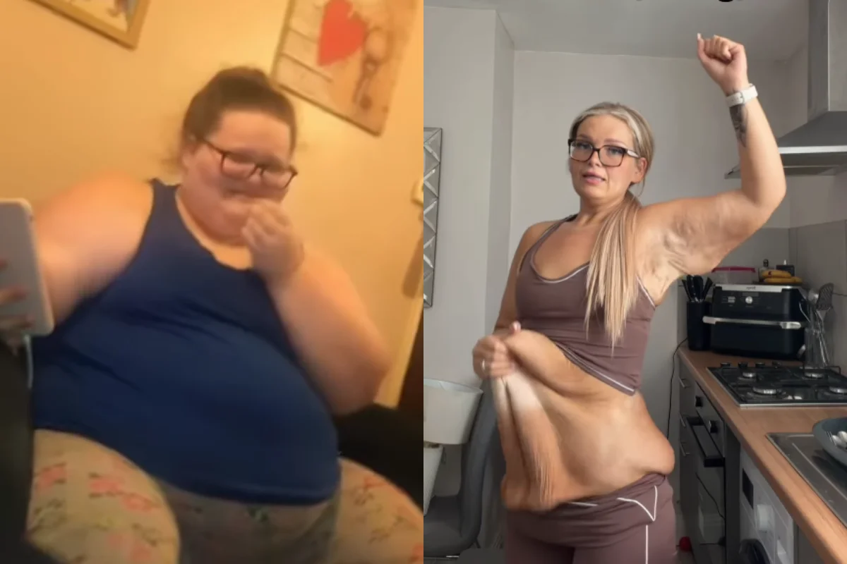 Mãe de 2 Filhos Perde 152 kg: 'Vitória' Depois da Cirurgia