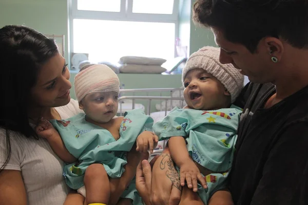 Lis, siamesa separada por cirurgia, tem alta de UTI e se junta à irmã
