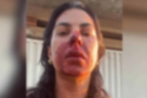 Oficial de Justiça agredida por PM