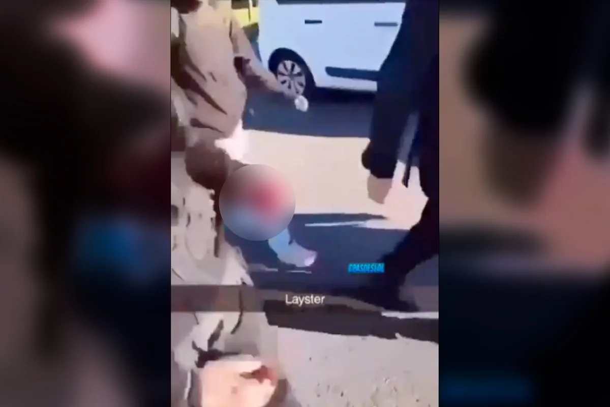 Explosão da granada arrancou a mão esquerda de estudante Explosão da granada arrancou a mão esquerda de estudante