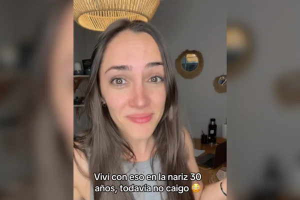 Influenciadora argentina Candela fala sobre ter ficado anos com bola de fita adesiva no nariz