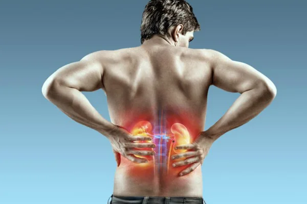 Pedra nos rins: o que é, quais são os sintomas e como prevenir