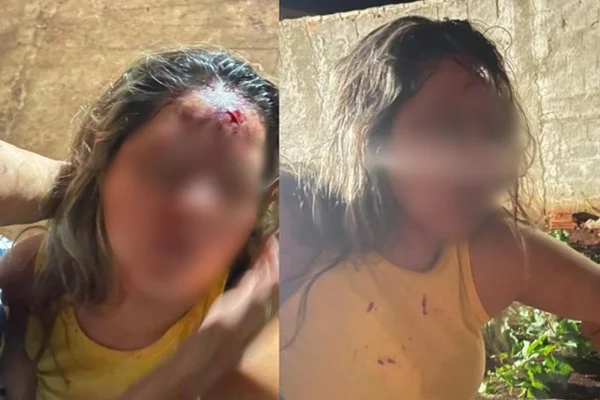 imagem colorida de mulher agredida por cantor sertanejo em goiás