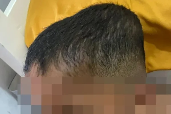 Foto colorida de menino autista em Arapiraca que teria sofrido agressões da babá - Metrópoles