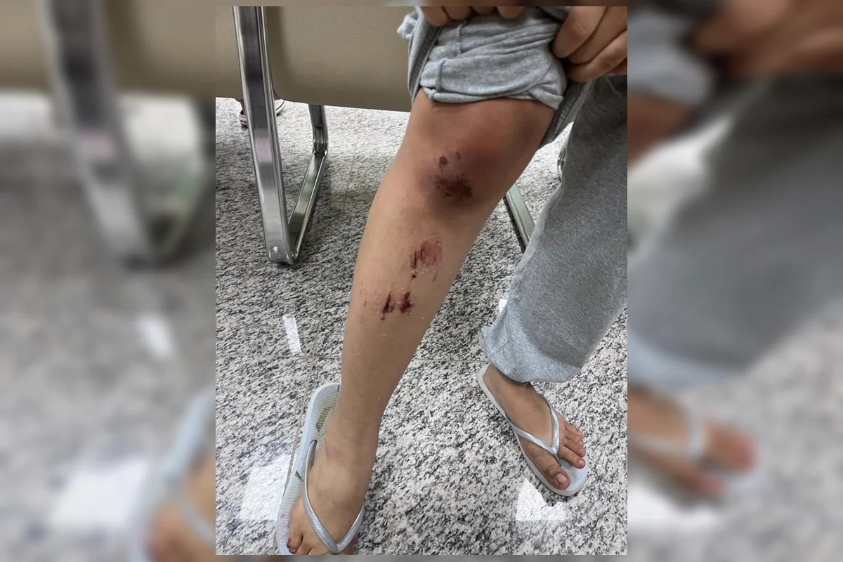 A reportagem revela novos detalhes do relato das vítimas sobre o ataque e a fuga do agressor A reportagem revela novos detalhes do relato das vítimas sobre o ataque e a fuga do agressor