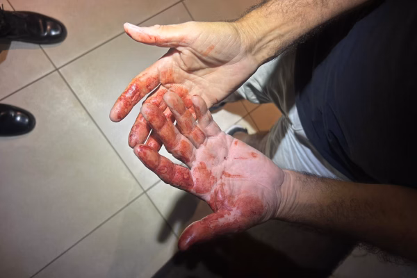 pai-machucado-1200x800-1 Vídeo mostra tensão em negociação de PMs e rapaz que esfaqueou pai