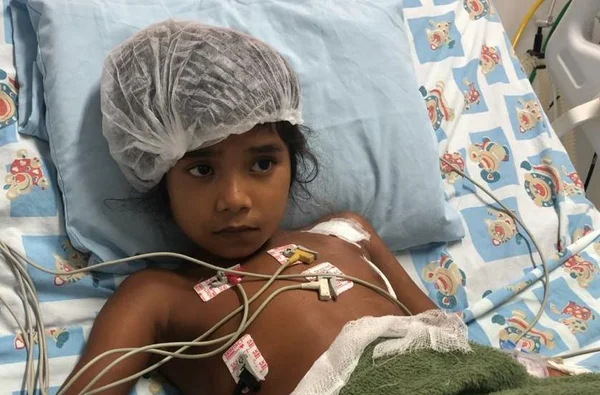 Criança indígena “renasce” após 4 meses com marca-passo avariado