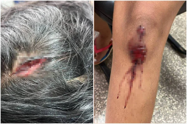 Sangue no chão e lesões no corpo: jovem é agredida por cunhado