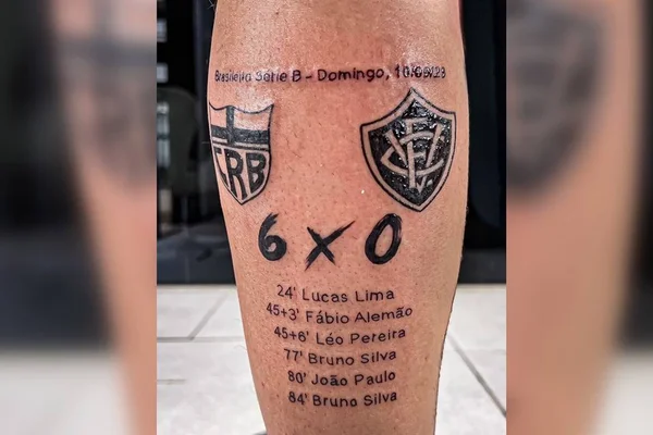 Imagem mostra tatuagem de torcedor para marcar resultado inesperado de partida de futebol - Metrópoles
