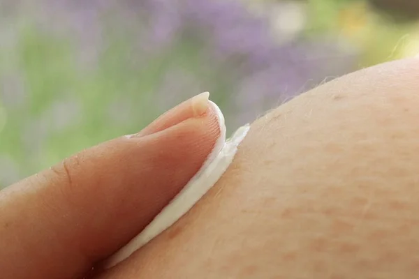 Creme para verrugas